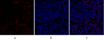 Rb Polyclonal Antibody