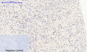 Rb Polyclonal Antibody