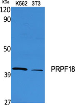 PRPF18 Polyclonal Antibody