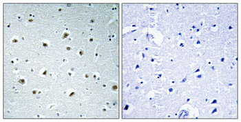 POLR2E Polyclonal Antibody