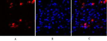 PKC Polyclonal Antibody