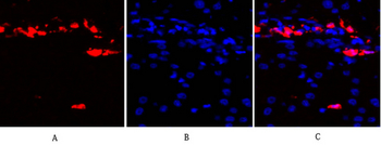 PKC Polyclonal Antibody