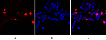PKC Polyclonal Antibody