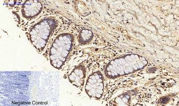 PKC Polyclonal Antibody