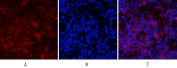 PI 3-kinase p85α Polyclonal Antibody