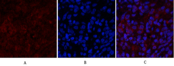 PI 3-kinase p85α Polyclonal Antibody