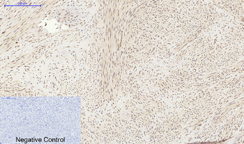 PI 3-kinase p85α Polyclonal Antibody
