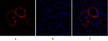 PI 3-kinase p110α Polyclonal Antibody