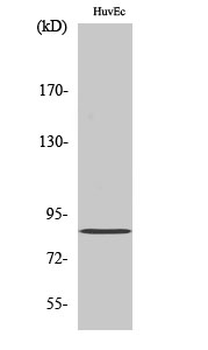PFK-C Polyclonal Antibody