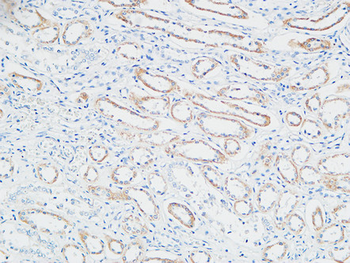PBF Polyclonal Antibody
