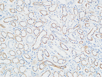 PBF Polyclonal Antibody
