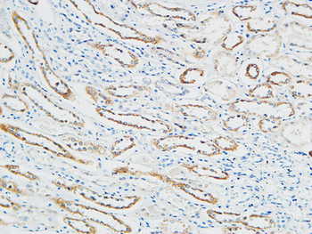 PBF Polyclonal Antibody