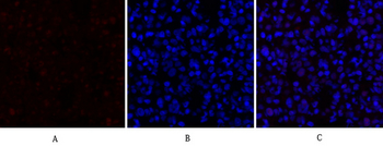 p70 S6 kinase α Polyclonal Antibody