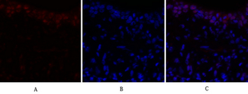p70 S6 kinase α Polyclonal Antibody