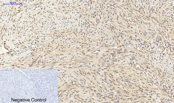 p70 S6 kinase α Polyclonal Antibody