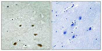 p38 Polyclonal Antibody