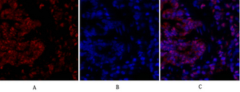 NFκB-p105/p50 Polyclonal Antibody