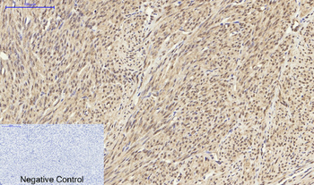 NFκB-p105/p50 Polyclonal Antibody