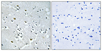 N4BP1 Polyclonal Antibody