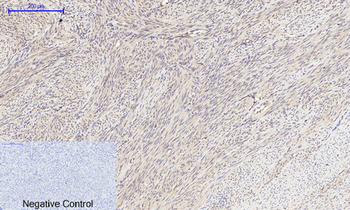 mTOR Polyclonal Antibody