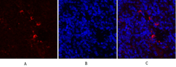 MMP-2 Polyclonal Antibody