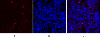 MMP-2 Polyclonal Antibody