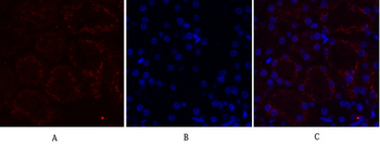 MMP-2 Polyclonal Antibody