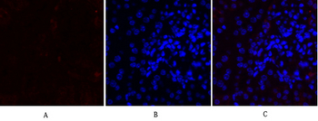MMP-2 Polyclonal Antibody