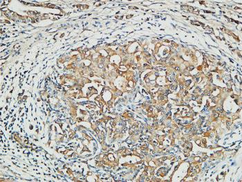 MMP-13 Polyclonal Antibody