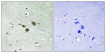 ME3 Polyclonal Antibody