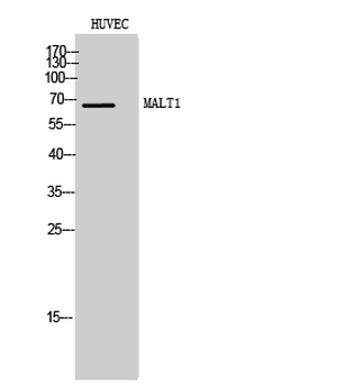 MALT1 Polyclonal Antibody