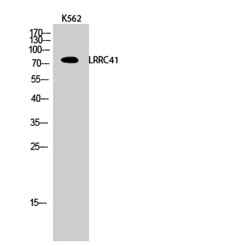 LRRC41 Polyclonal Antibody