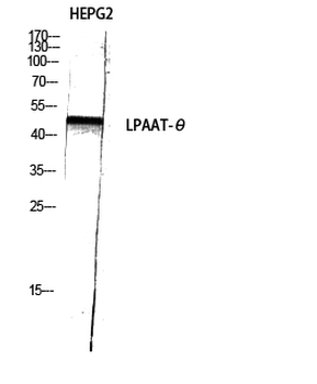 LPAAT-θ Polyclonal Antibody