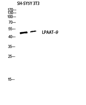 LPAAT-θ Polyclonal Antibody