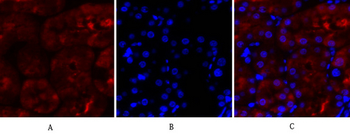 Lamin A/C Polyclonal Antibody