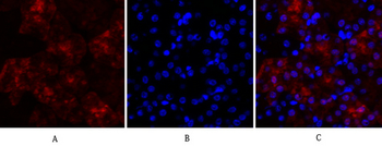 Lamin A/C Polyclonal Antibody