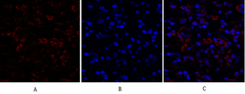 Ki-67 Polyclonal Antibody