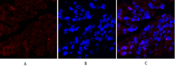 Ki-67 Polyclonal Antibody