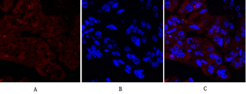 Ki-67 Polyclonal Antibody