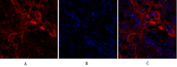 Ki-67 Polyclonal Antibody