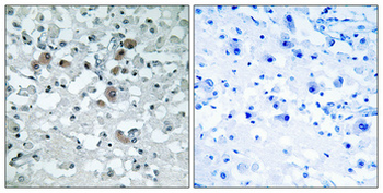 KDEL Receptor 3 Polyclonal Antibody
