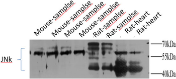 JNK1/2/3 Polyclonal Antibody