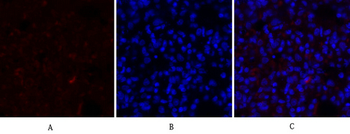 IκB-α Polyclonal Antibody