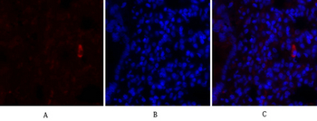 IκB-α Polyclonal Antibody
