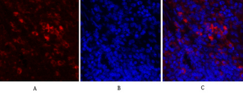 IκB-α Polyclonal Antibody