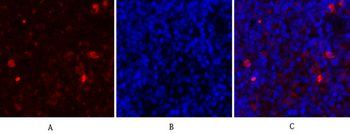 IκB-α Polyclonal Antibody