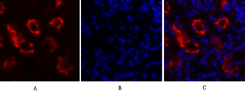 IκB-α Polyclonal Antibody