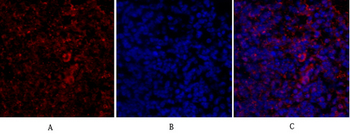 IRS-1 Polyclonal Antibody