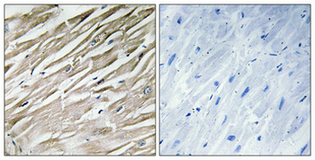 IPP-2 Polyclonal Antibody