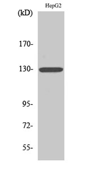 IL-3Rβ Polyclonal Antibody